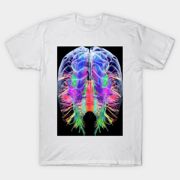 White matter fibres and brain, artwork (C015/1936) T-Shirt by SciencePhoto